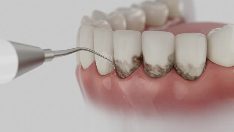 Trusted Tooth Extraction service in Eldorado, TX - Dentist Open Now
